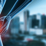 Discover Top Chiropractors in Manila: Your Path to Pain Relief
